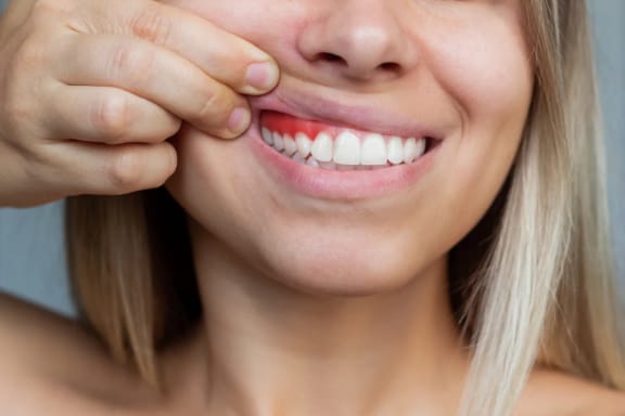 A patient experiencing gum discomfort
